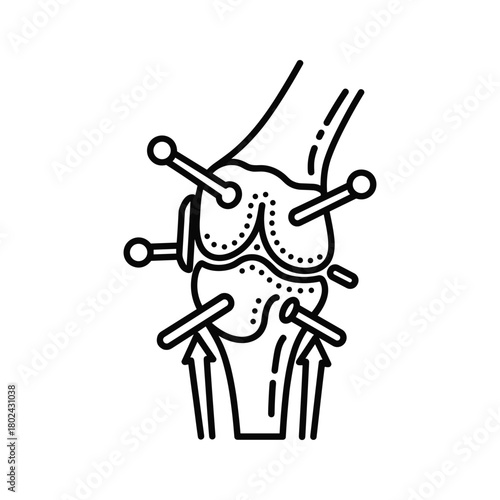 Knee joint with medical pins, orthopedic surgery or injury repair