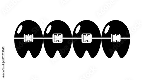 Vector illustration of closeup of black dental braces on a transparent background, showing brackets and wire 