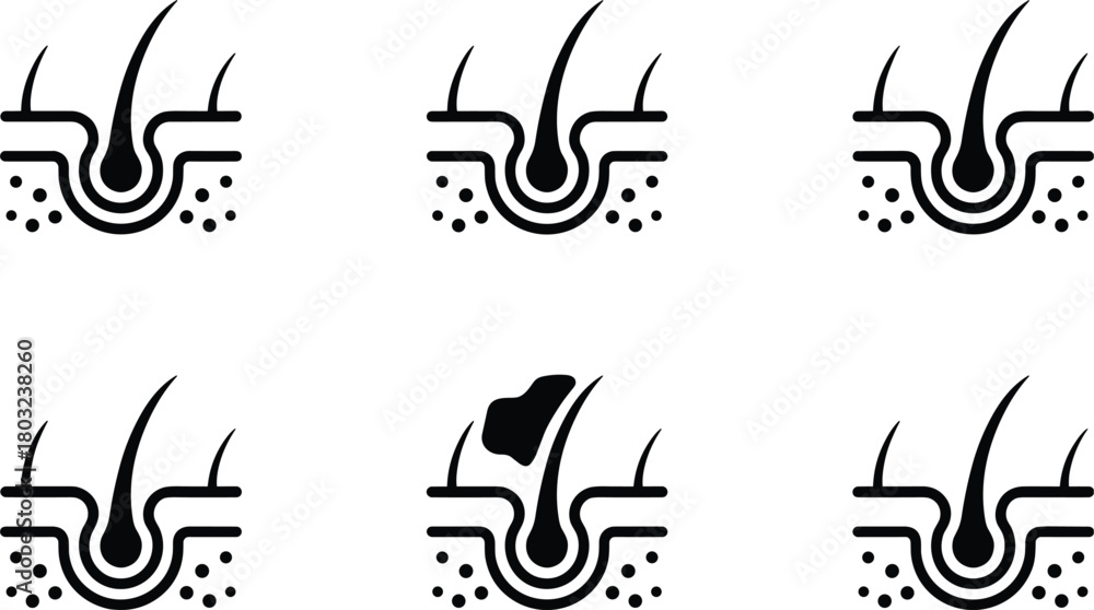 Obraz premium Six icons illustrating hair follicle and skin conditions in black and white scalp root