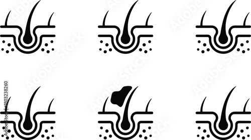 Six icons illustrating hair follicle and skin conditions in black and white scalp root