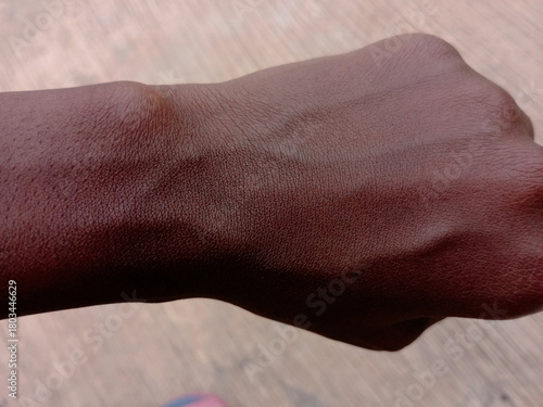 Green veins at the back of palm of an African woman on blurred background.