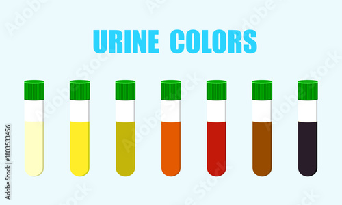 Urine color test on background. the colors of urine tell us about health.  