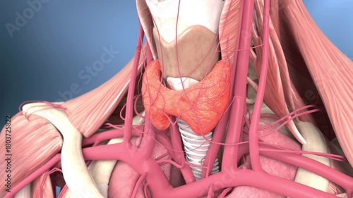 Thyroid cancer, thyroid nodules, hyperthyroidism, goiter, thyroid tumors, metastatic cancer, endocrine disorders, glandular anatomy, pharyngeal masses, human neck anatomy,3D animation.Horizontal video