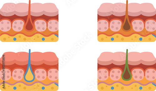 Skin cross section illustration, hair follicle anatomy vector, epidermis dermis diagram, human skin layers graphic, dermatology medical artwork