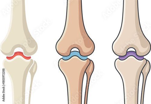 Human knee joint illustration, bone anatomy graphic, medical cartilage diagram, orthopedic vector art, skeletal joint structure, healthcare anatomy icon set