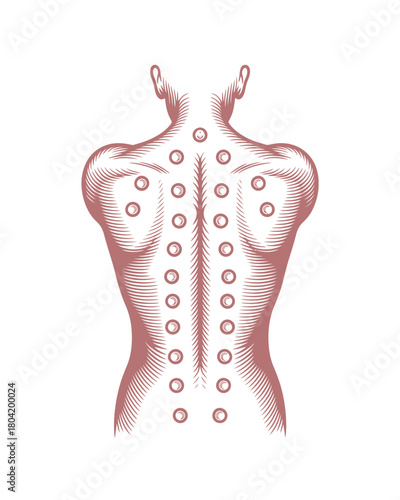 Cupping Therapy Body Healing Back Pain Relief