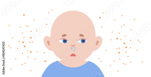 Allergic rhinitis poster