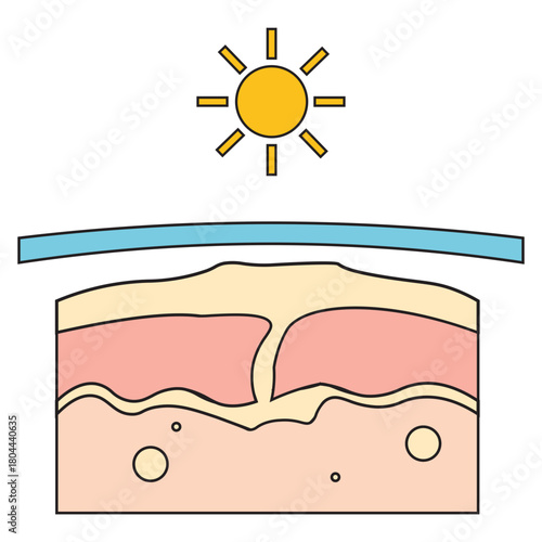 UV Defense and Healthy Skin Illustration