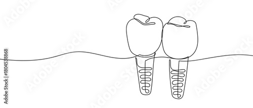 Dental implants in one continuous line simple linear style. Editable stroke.