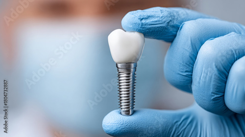 Close up of titanium dental implant held in tweezers by gloved hand for medical use