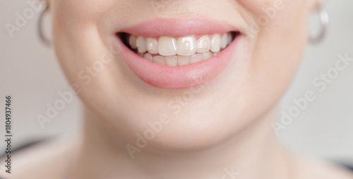 Tableau sur toile Close-up of female adult caucasian smiling with crooked teeth and pink lips