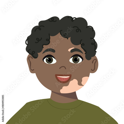 Cartoon portrait of a smiling boy with vitiligo spots on face. Vector illustration isolated on a white background. 