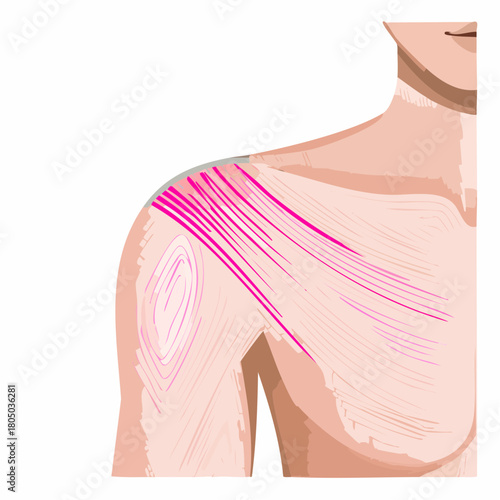 A series of parallel, raised scratch marks visible on the upper shoulder, slightly inflamed and pink.