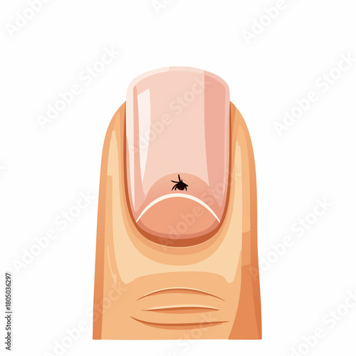 A close-up view of a recently removed splinter, leaving a small, clean entry hole in the fingertip.