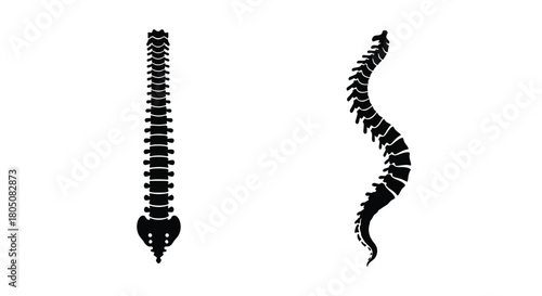 A comparison of healthy and curved spinal columns anatomical illustration