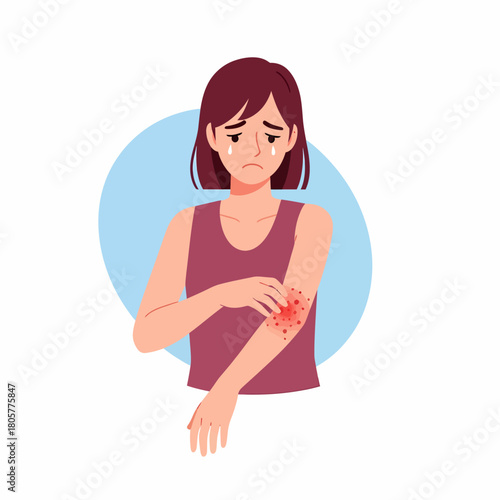 Crying Woman Scratching Itchy Arm Rash. Allergic Reaction, Eczema, or Dermatitis Concept. Flat Vector Illustration.