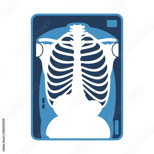 Chest X-ray Illustration - Detailed Anatomical View of Rib Cage and Torso.