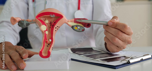 Obraz na płótnie Gynecologist points with pen to anatomical model of uterus and ovaries