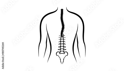 Scoliosis spine curvature spinal column human back illustration