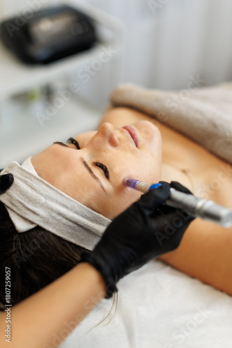 A close-up of a woman receiving microneedling therapy with a dermapen device on her cheek. The treatment is performed by a gloved professional in a serene spa setting