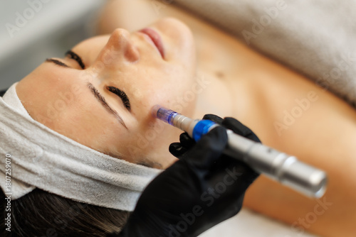 A close-up of a woman receiving microneedling therapy with a dermapen device on her cheek. The treatment is performed by a gloved professional in a serene spa setting