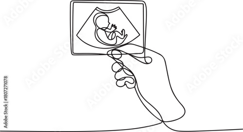 continuous line hand holding ultrasound photo of baby. scan photo of baby in womb. one line Icon drawing with white background