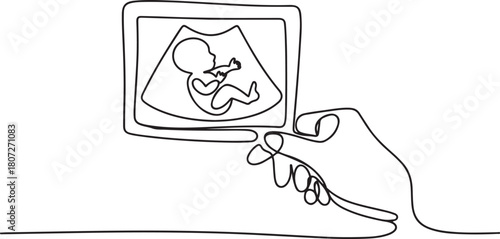 continuous line hand holding ultrasound photo of baby. scan photo of baby in womb. one line Icon drawing with white background