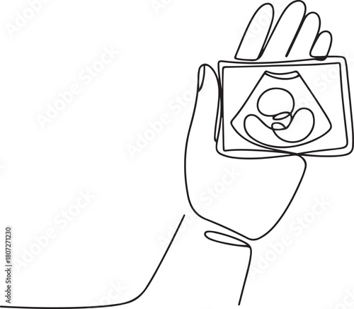 continuous line hand holding ultrasound photo of baby. scan photo of baby in womb. one line Icon drawing with white background