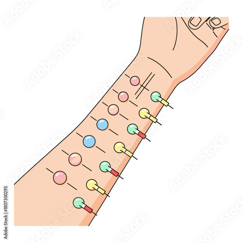 Allergy test with colorful markers on forearm skin surface  