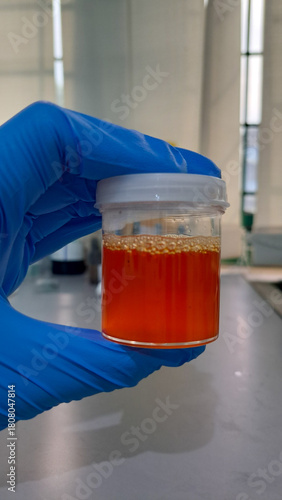 An analyst's hand is holding a pot of urine to conduct an examination in the laboratory, a health concept.