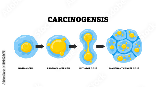 Carcinogenesis process development from genetic changes or mutation, doubling to cell division. Labeled Proto-cancer,initiator cells,malignant cancer cells. Mutagenesis, tumorigenesis. Tumor formation