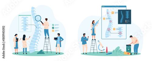 Diagnosis and treatment of spinal column diseases. set. Tiny people check for inflammation in human intervertebral discs on medical anatomy chart and xray of patient cartoon vector illustration