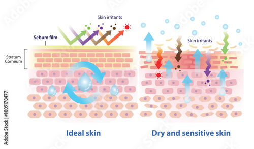 Comparison of ideal, dry and sensitive skin illustration. Intercellular lipids hold water and link the cells together, the sebum protect skin from irritants. When sebum decreased, the skin damaged.