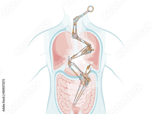 Robotic Surgery Illustration: Advanced Medical Technology for Precision in the Human Body, Featuring a Stylized Depiction of Organs and Robotic Arms for Innovative Surgical Procedures