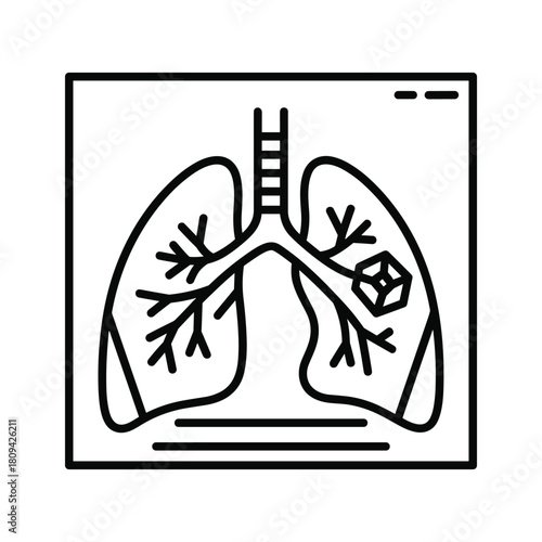 Lung cancer xray isolated on shows tumor in the respiratory system of human body