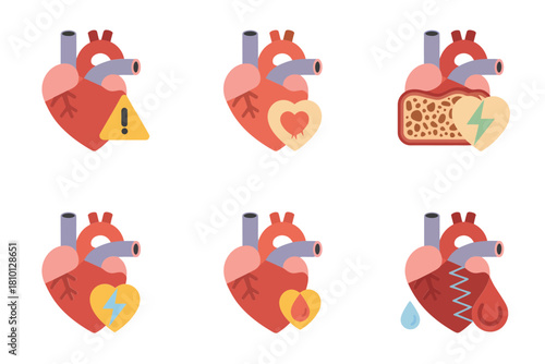 Anatomical heart condition icons set, warning symbol, heartbeat stress, blocked artery plaque, cold therapy, stitched scar, medical vector