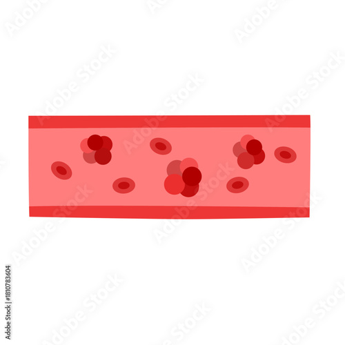 cancer tumor cell developing concept