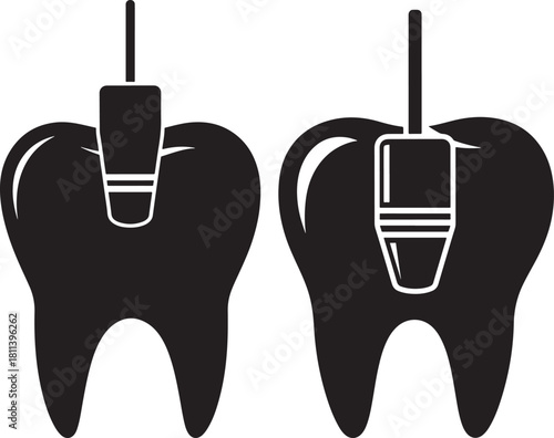 Dental implant procedure diagram silhouette showing tooth restoration