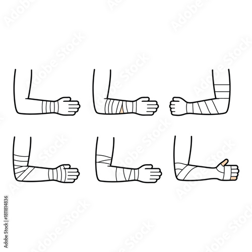 Illustration of human arms with various bandages and wraps