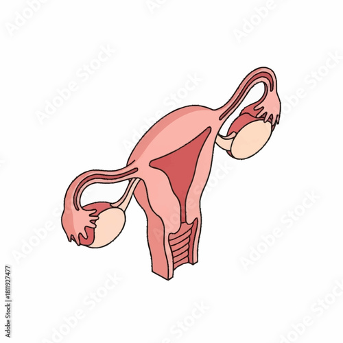Anatomical illustration of the female reproductive system with uterus and ovaries.