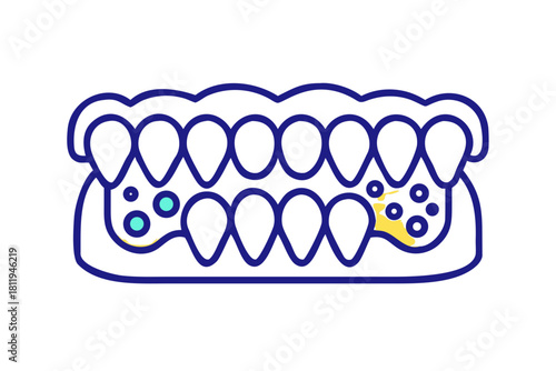 Zahnbelag, Verfärbungen, Zahnstein intraoral.
