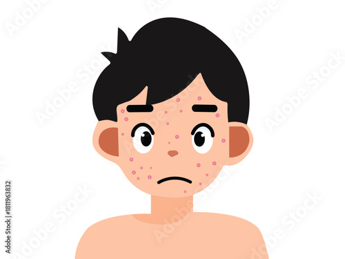 Men with acne
