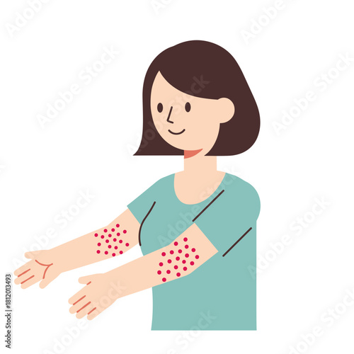 Young woman showing rash on arms while smiling in casual setting  