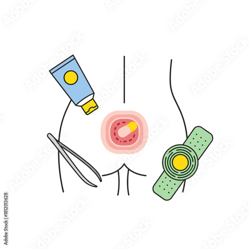 Treatment of pressure ulcer with ointment and bandages on skin  