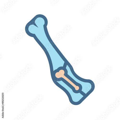 Bone anatomy illustration featuring structure and detail on black background for medical infographics