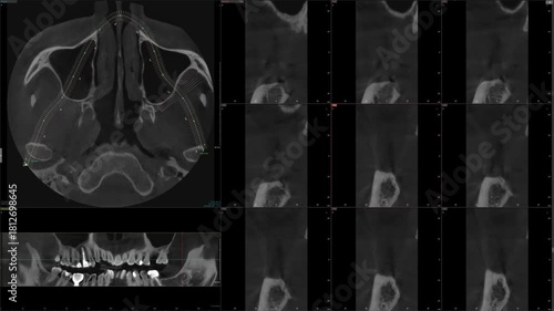 Screen of software for MRI of teeth. Monitoring of dental health using skull scan. Dental examination. Examination at the dentist.