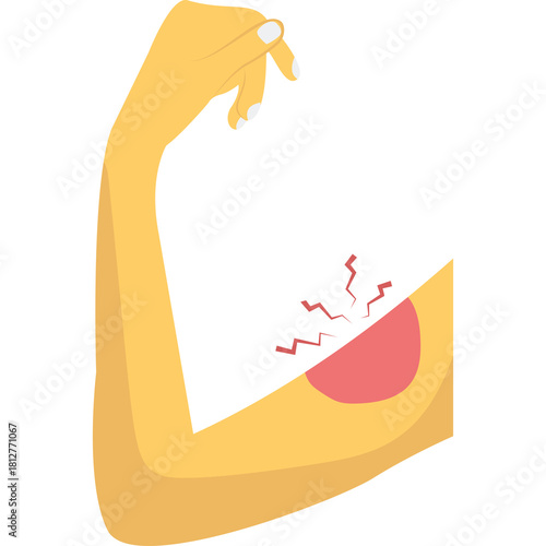 Human Arm Experiencing Painful Red Rash Irritation and Discomfort on Skin Caused by Allergic Reaction or Dermatitis with Delicate Fingers and Yellow Skin Tone Isolated on Transparent Background