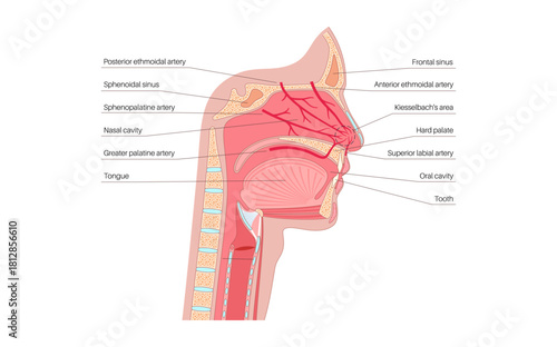 Nosebleed medical poster