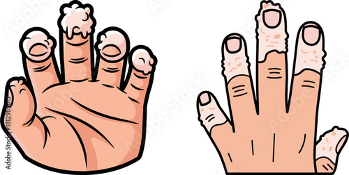 Illustration of two human hands showing fingers covered in foam bubbles and a grainy texture, on a transparent background with a cartoon style.