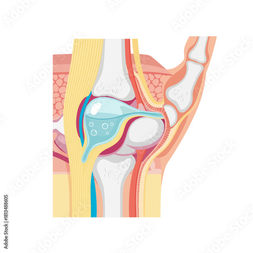 Detailed cross section of a human joint, showing synovial fluid and gas bubbles, illustrating